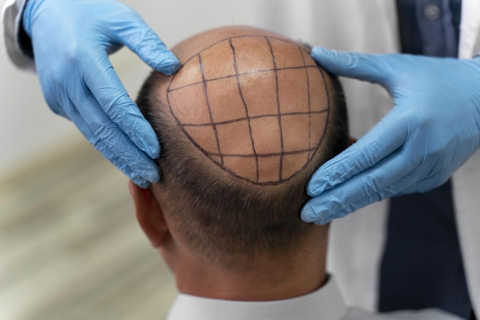 Hair g034c7afd5 1920