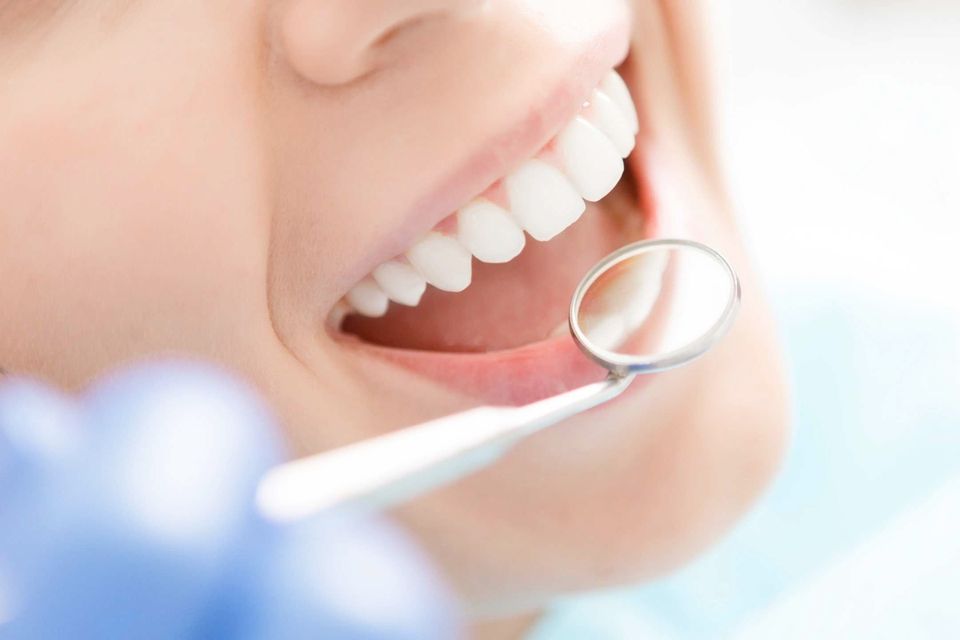 Dental Cleaning Cavity Prevention | Schmitz Dental
