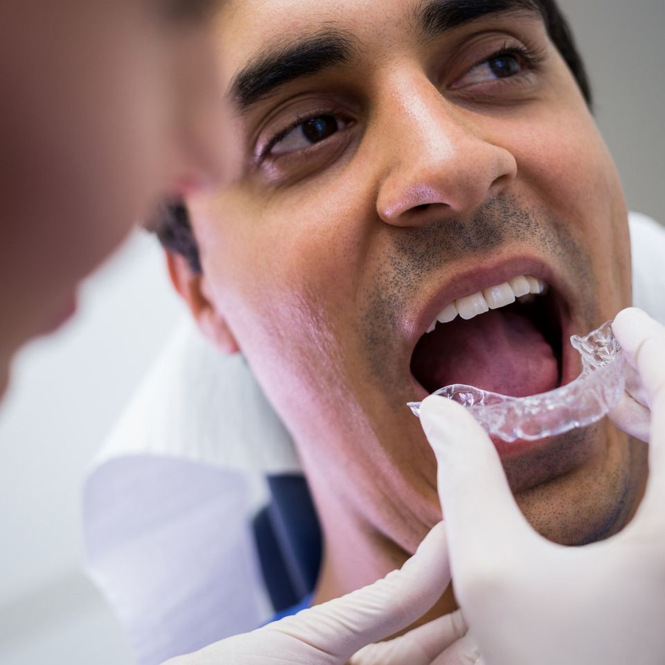 Clear aligners
